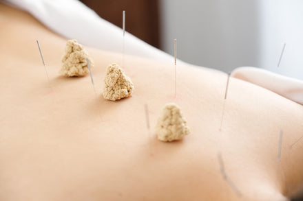Let’s Talk Acupuncture for Women’s Health